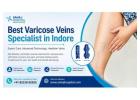 Best Varicose veins specialist in Indore