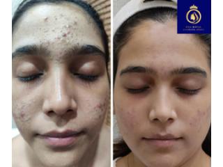 Professional Anti Ageing Skin Care Services in Thane | DNA Royal.