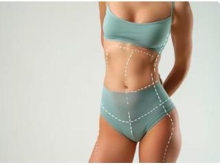 Tummy Tuck South Africa for a Slimmer Body Shape