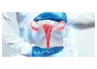 Best Gynecologist