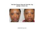 Dark Spot Corrector Serum for Dark Skin: Say Goodbye to Uneven Tone