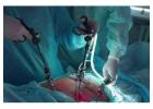 Affordable Gallbladder Stone Operation Package in Kolkata  