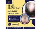 Top Rated No.1 Hair Transplant Clinic in Thane | DNA Royal.