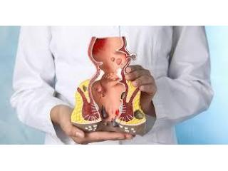 Best Piles Surgeon in Kolkata for Expert Treatment