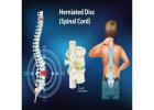 Herniated Disc Treatment by the Best Spine Surgeon in Ahmedabad, Gujarat, India