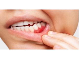 Burton Family Dental | Expert Dental Care at Burton Advance Dental