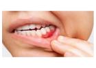 Burton Family Dental | Expert Dental Care at Burton Advance Dental