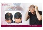 Find the Best Hair Doctor in Bangalore for Advanced Hair Care - Dr. Priya Skin and Hair Clinic