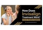 How Does Invisalign Treatment Work? Cost & Timeline Explained