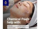 Get Radiant Skin with Chemical Face Peel in Thane at DNA Royal.