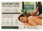 Acupuncture Treatment Service in Culver City: Natural Healing