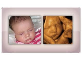 See Your Baby Clearly | Hd Ultrasound Experience in Anaheim, CA