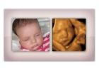 See Your Baby Clearly | Hd Ultrasound Experience in Anaheim, CA 
