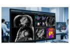 Detailed Cardiac MRI Scan in Mumbai at Picture This 