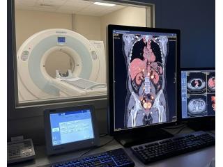 Accurate PSMA PET CT Scan for Prostate Cancer at Picture This