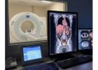 Accurate PSMA PET CT Scan for Prostate Cancer at Picture This 