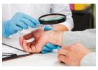 Psoriasis Treatment in Delhi – Advanced Care at Iksana Wellness