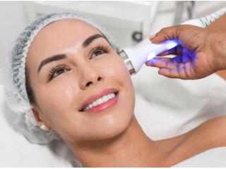 IPL (Intense Pulsed Light) | Altamonte Springs, Orlando, Daytona Beach & Clermont