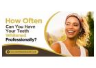 How Often Can You Have Your Teeth Whitened Professionally?