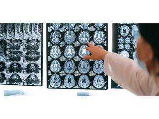 Can PEMF Therapy Towson MD Ellicott City MD Help You?