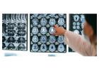 Can PEMF Therapy Towson MD Ellicott City MD Help You?