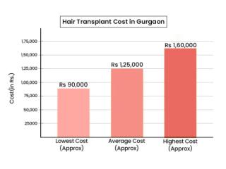 Affordable Hair Transplant Cost in Gurgaon – Book Consultation
