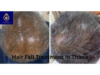 Best Hair Fall Treatment in Thane – Expert Solutions at DN A Royal.