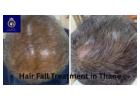 Best Hair Fall Treatment in Thane – Expert Solutions at DN A Royal.