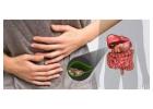 Trusted Surgical Expertise for Gall Stone Treatment in Kolkata