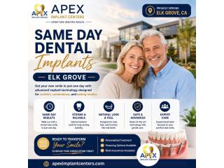 Same Day Dental Implants Elk Grove - apeximplantcenters.com