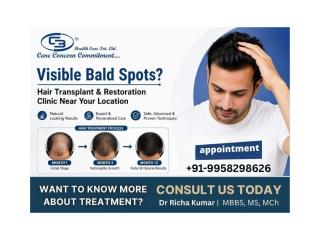 Visible Bald Spots? Hair Transplant & Restoration Clinic Near Your Location