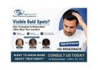 Visible Bald Spots? Hair Transplant & Restoration Clinic Near Your Location