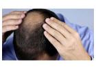 Proven Hair Treatment for Hair Loss – Restore Fullness and Confidence Today
