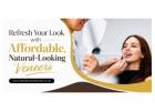 Refresh Your Look with Affordable, Natural-Looking Veneers