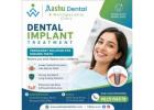 Dental Implants Treatment Ahmedabad | DR. Manish Shah