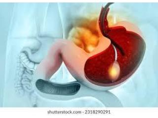 Expert Endoscopy Solutions by the Best Endoscopist in Ahmedabad