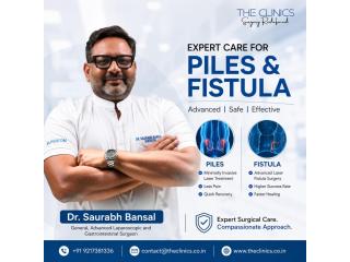 Best Piles Surgery in India | Advanced Laser & Minimally Invasive
