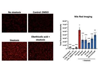 Research Experts Advance Non-Alcoholic Steatohepatitis Studies with Precision
