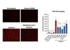 Research Experts Advance Non-Alcoholic Steatohepatitis Studies with Precision