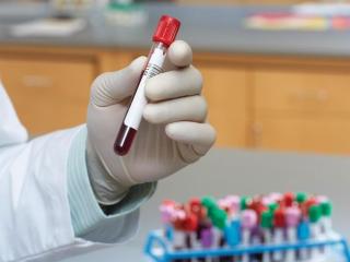 Free HIV and STD Testing