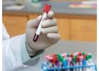 Free HIV and STD Testing