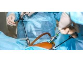 Hospital for Laparoscopic Surgery in Kolkata