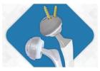Advanced Total Hip Replacement Prosthesis Implants | Sharma Orthopedic