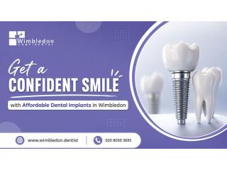 Get a Confident Smile with Affordable Dental Implants in Wimbledon