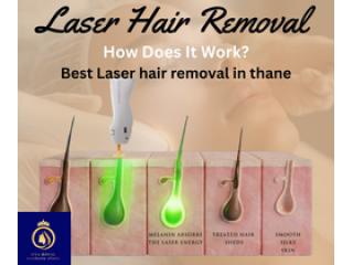 Achieve Smooth Skin with Best Laser Hair Removal in Thane by DNA Royal.