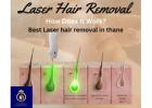 Achieve Smooth Skin with Best Laser Hair Removal in Thane by DNA Royal.