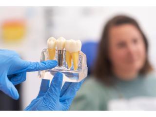 Restore Missing Teeth with Dental Implants in San Antonio