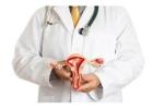 Uterine Fibroid Embolization Cost in India Advanced UFE Care | IRFacilities