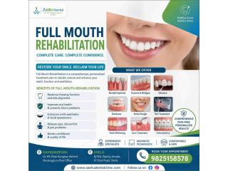 Full Mouth Rehabilitation in Navrangpura | DR. Manish Shah