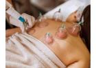 Cupping Therapy Services: Natural Pain Relief and Holistic Healing